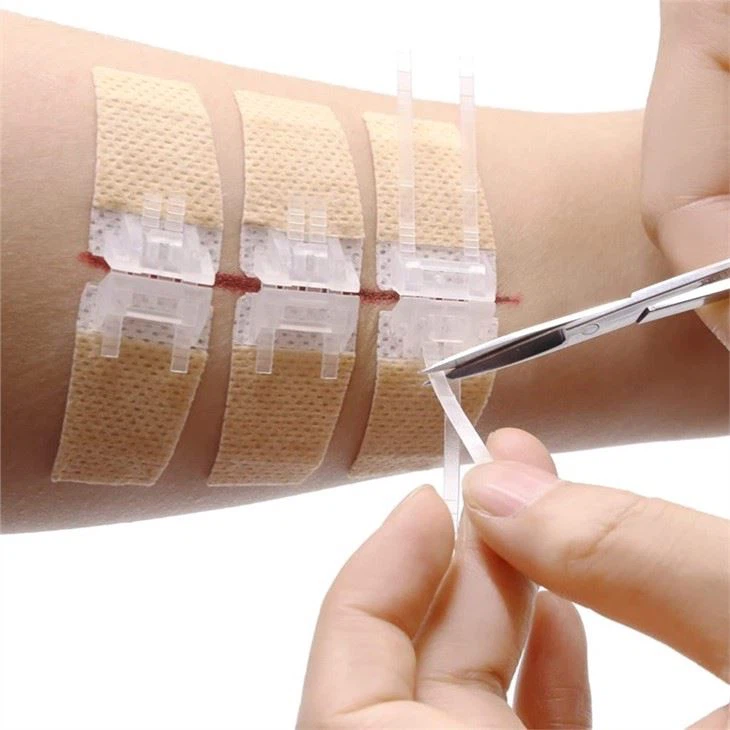 Refill Kits